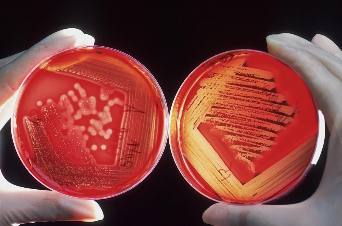 Can Follistatin-344 Peptide Increase Cell Proliferation and Health