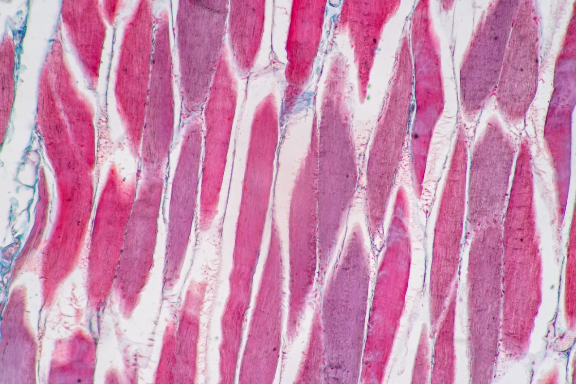 MGF IGF-1 Ec Peptide Potential For Muscle Cell Research